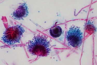 Cannabis Mycotoxins Testing in California